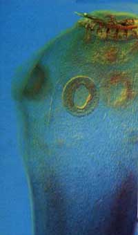 beef tapeworm common in human intestine